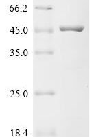 Escherichia coli DNA gyrase subunit B (gyrB), partial Recombinant Protein, N-His, aa 2–392, E.coli - BioCrest Sci