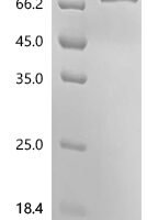 Human Cell surface glycoprotein CD200 receptor 1 (CD200R1) Recombinant Protein - BioCrest Sci