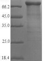 Human A-kinase anchor protein 4 (AKAP4) Recombinant Protein - BioCrest Sci