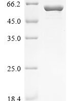 Arabidopsis thaliana Acetolactate synthase, chloroplastic (ALS), partial Recombinant Protein, N-10His - BioCrest Sci