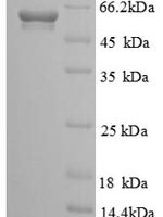 Human Soluble calcium-activated nucleotidase 1 (CANT1), partial Recombinant Protein, N-GST - BioCrest Sci