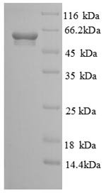 Human Soluble calcium-activated nucleotidase 1 (CANT1), partial Recombinant Protein, N-GST, Homo sapiens (Human), E.coli, N-terminal GST-tagged, 62.4 kDa, purity >≥ 90% as determined by SDS-PAGE.