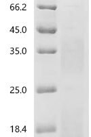Mouse Hypoxia-inducible factor 1-alpha (Hif1a), partial Recombinant Protein, N-His, aa 380–585, Yeast - BioCrest Sci