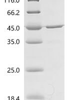 Mouse Ataxin-3 (Atxn3) Recombinant Protein, N-His - BioCrest Sci