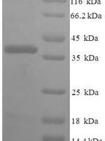 Human Fin bud initiation factor homolog (FIBIN) Recombinant Protein - BioCrest Sci
