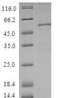 Human ZW10 interactor (ZWINT) Recombinant Protein - BioCrest Sci