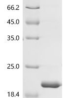 Macaca fascicularis Kidney associated antigen 1 Recombinant Protein - BioCrest Sci