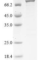 Human Nuclear pore complex protein Nup85 (NUP85) Recombinant Protein - BioCrest Sci