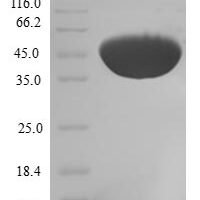 Human Cofilin-2 (CFL2) Recombinant Protein - BioCrest Sci