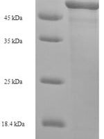Human L-2-hydroxyglutarate dehydrogenase, mitochondrial (L2HGDH) Recombinant Protein, N-His-SUMO, Mature - BioCrest Sci