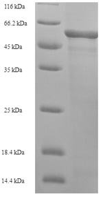 Human L-2-hydroxyglutarate dehydrogenase, mitochondrial (L2HGDH) Recombinant Protein, N-His-SUMO, Mature, Homo sapiens (Human), E.coli, N-terminal 6xHis-SUMO-tagged, 61.3 kDa, purity >≥ 90% as determined by SDS-PAGE.