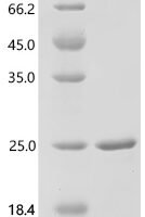 Human Cyclin-dependent kinase 4 inhibitor B(CDKN2B) Recombinant Protein - BioCrest Sci