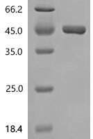Mouse Gastrokine-1 (Gkn1) Recombinant Protein - BioCrest Sci