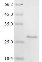 Bos indicus x Bos taurus Alpha-S1-casein, partial Recombinant Protein, C-His, aa 56–181 (111:E→Missing,△140–149) - BioCrest Sci