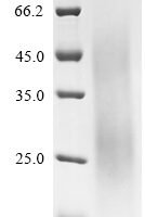 Rhipicephalus sanguineus Evasin-3 Recombinant Protein - BioCrest Sci