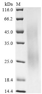 Rhipicephalus sanguineus Evasin-3 Recombinant Protein, Rhipicephalus sanguineus (Brown dog tick) (Ixodes sanguineus), Yeast, C-terminal 6xHis-tagged, 8.5 kDa, purity >≥ 85% as determined by SDS-PAGE.