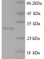 Human Forkhead box protein P3 (FOXP3), partial Recombinant Protein - BioCrest Sci