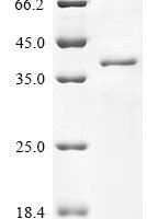 Magnaporthe oryzae Cutinase (CUT1) Recombinant Protein - BioCrest Sci
