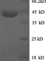 Human Bone morphogenetic protein 7 (BMP7) Recombinant Protein - BioCrest Sci