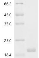 Human Surfactant-associated protein 2 (SFTA2) Recombinant Protein, N-His-SUMO - BioCrest Sci
