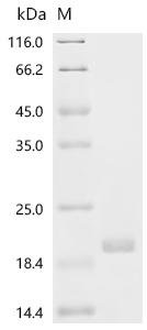 Human Surfactant-associated protein 2 (SFTA2) Recombinant Protein, N-His-SUMO, Homo sapiens (Human), E.coli, N-terminal 6xHis-SUMO-tagged, 24.7 kDa, purity >≥ 85% as determined by SDS-PAGE.