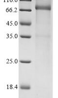 Human Mannan-binding lectin serine protease 2 (MASP2) Recombinant Protein - BioCrest Sci