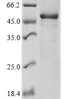 Human ADP-ribosyl cyclase/cyclic ADP-ribose hydrolase 1 (CD38), partial Recombinant Protein - BioCrest Sci