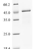 Human Vitamin K-dependent protein C (PROC) Recombinant Protein - BioCrest Sci