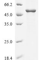 Tick-borne encephalitis virus Far Eastern subtype Genome polyprotein, partial Recombinant Protein, N-His - BioCrest Sci