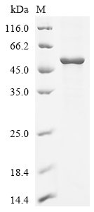 Tick-borne encephalitis virus Far Eastern subtype Genome polyprotein, partial Recombinant Protein, N-His, Tick-borne encephalitis virus Far Eastern subtype (strain Sofjin) (SOFV) (Sofjin virus), E.coli, N-terminal 6xHis-tagged, 52.8 kDa, purity >≥ 85% as determined by SDS-PAGE.
