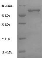Mycobacterium tuberculosis Steroid C26-monooxygenase (cyp125) Recombinant Protein, N-His - BioCrest Sci