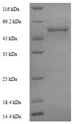 Mycobacterium tuberculosis Steroid C26-monooxygenase (cyp125) Recombinant Protein, N-His, Mycobacterium tuberculosis (strain CDC 1551 / Oshkosh), Yeast, N-terminal 6xHis-tagged, 50.4 kDa, purity >≥ 90% as determined by SDS-PAGE.