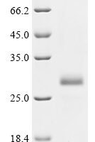 Mouse Insulin-1 (Ins1) Recombinant Protein, N-His/C-Myc - BioCrest Sci