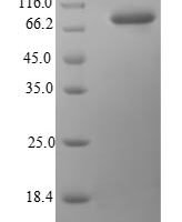 Human Heat shock protein HSP 90-beta (HSP90AB1) Recombinant Protein, N-10His/C-Myc - BioCrest Sci