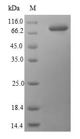 Human Heat shock protein HSP 90-beta (HSP90AB1) Recombinant Protein, N-10His/C-Myc, Homo sapiens (Human), E.coli, N-terminal 10xHis-tagged and C-terminal Myc-tagged, 88.1 kDa, purity >≥ 90% as determined by SDS-PAGE.
