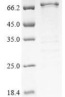 Hepatitis B virus genotype C subtype ayr External core antigen (C),Biotinylated Recombinant Protein - BioCrest Sci