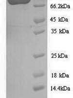 Aquifex aeolicus DNA mismatch repair protein MutS (mutS) Recombinant Protein - BioCrest Sci