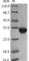 Triticum aestivum Trypsin/alpha-amylase inhibitor CMx1/CMx3 Recombinant Protein - BioCrest Sci