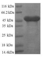 Human 60S ribosomal protein L11 (RPL11), partial Recombinant Protein - BioCrest Sci