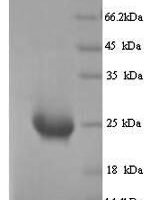 Human Butyrophilin subfamily 2 member A1 (BTN2A1), partial Recombinant Protein - BioCrest Sci