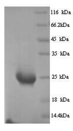 Human Butyrophilin subfamily 2 member A1 (BTN2A1), partial Recombinant Protein, Homo sapiens (Human), Yeast, N-terminal 6xHis-tagged, 26.6 kDa, purity >≥ 90% as determined by SDS-PAGE.
