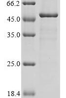 Human Guanine nucleotide-exchange factor SEC12 (PREB), partial Recombinant Protein - BioCrest Sci