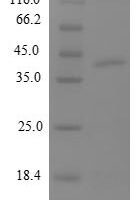Human 39S ribosomal protein L12, mitochondrial (MRPL12) Recombinant Protein - BioCrest Sci