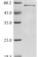 Canine coronavirus Nucleoprotein (N) Recombinant Protein, N-10His/C-Myc - BioCrest Sci