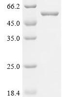 Glutamicibacter nicotianae Adenylate cyclase (cya) Recombinant Protein - BioCrest Sci