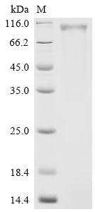 Human Receptor tyrosine-protein kinase erbB-2 (ERBB2)(S310Y), partial Recombinant Protein, Homo sapiens (Human), Mammalian cell, C-terminal 10xHis-tagged, 70.8 kDa, purity >≥ 90% as determined by SDS-PAGE.