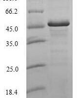 Human Histone H1.0 (H1-0) Recombinant Protein - BioCrest Sci