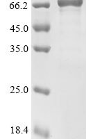 Human Calpain-8 (CAPN8) Recombinant Protein, Tag-Free - BioCrest Sci