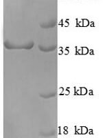Human Cyclin-dependent kinase 4 (CDK4) Recombinant Protein - BioCrest Sci