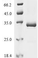 Bombyx mori Fibrohexamerin (P25) Recombinant Protein, C-His, aa 17–220, Yeast - BioCrest Sci